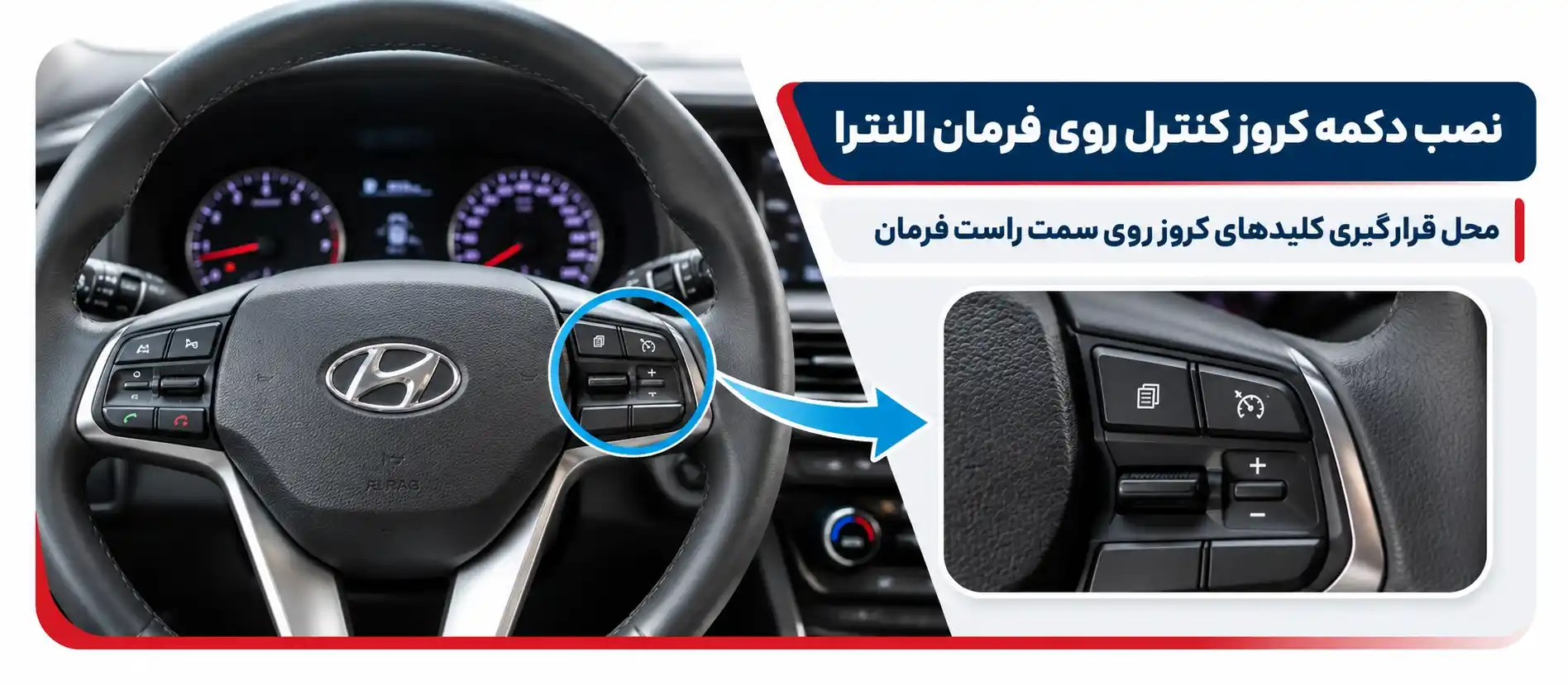 نصب دکمه کنترلی روی النترا